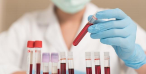Why You Should Go For Blood Tests Regularly